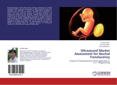 Ultrasound Marker Assessment  for Nuchal Translucency