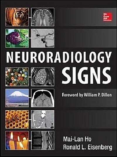 Neuroradiology Signs