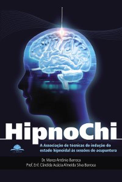 Hipnochi