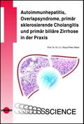 Autoimmunhepatitis, Overlapsyndrome, primär sklerosierende Cholangitis und primär biliäre Zirrhose in der Praxis