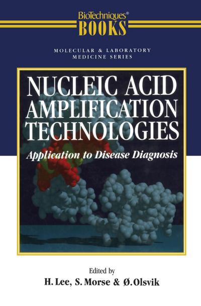 NUCLEIC ACID AMPLIFICATION TEC