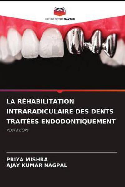 LA RÉHABILITATION INTRARADICULAIRE DES DENTS TRAITÉES ENDODONTIQUEMENT