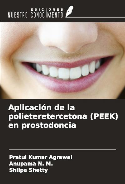 Aplicación de la polieteretercetona (PEEK) en prostodoncia