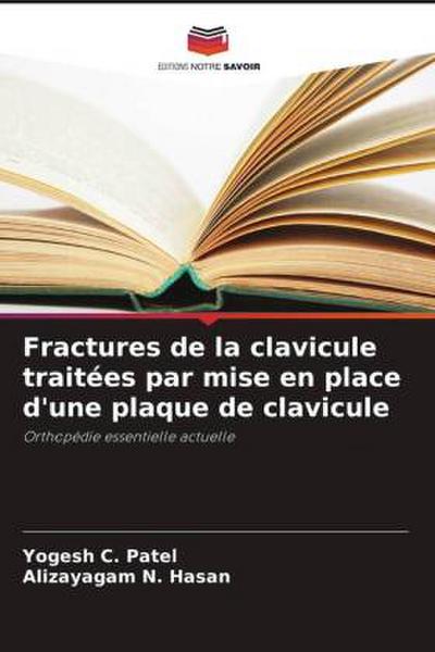 Fractures de la clavicule traitées par mise en place d’une plaque de clavicule