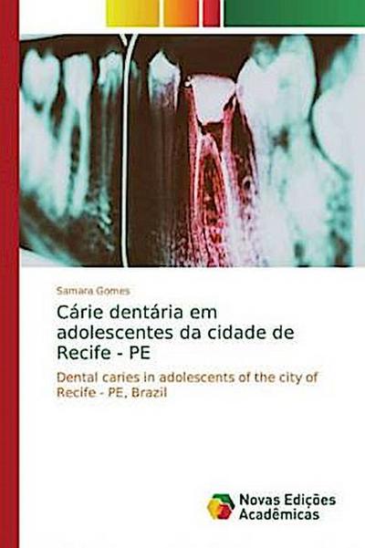 Cárie dentária em adolescentes da cidade de Recife - PE