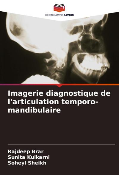 Imagerie diagnostique de l’articulation temporo-mandibulaire