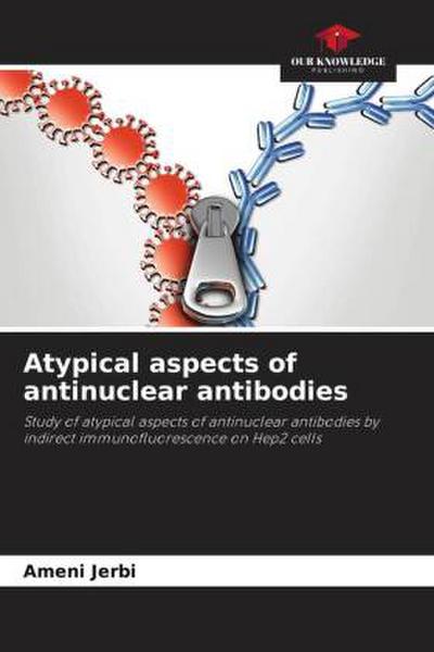 Atypical aspects of antinuclear antibodies