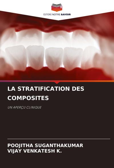 LA STRATIFICATION DES COMPOSITES
