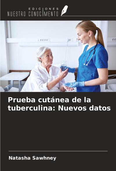 Prueba cutánea de la tuberculina: Nuevos datos