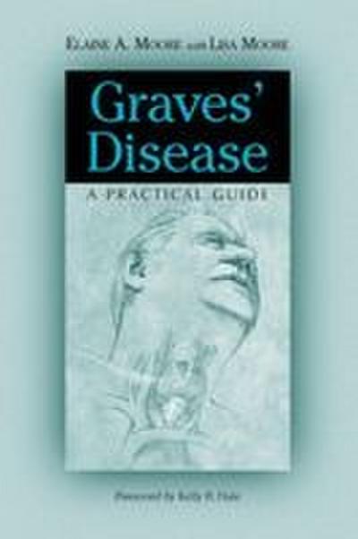 Graves’ Disease