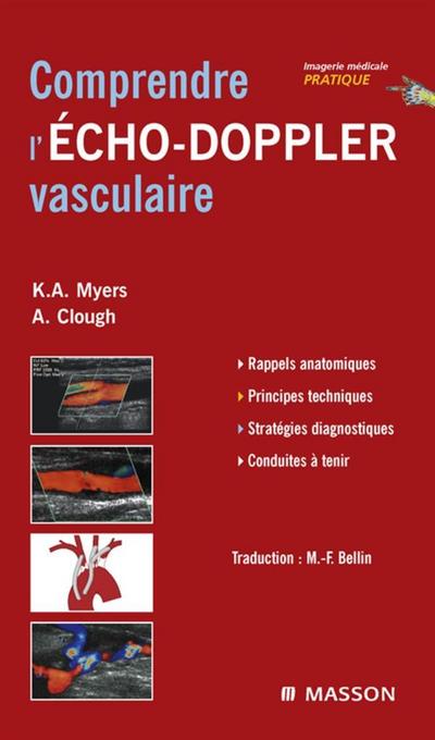 Comprendre l’Echo-Doppler vasculaire
