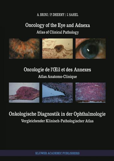 Oncology of the Eye and Adnexa / Oncologie de l’Oeil Et Des Annexes / Onkologische Diagnostik in Der Ophthalmologie: Atlas of Clinical Pathology / Atl