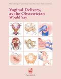 Vaginal Delivery, as the Obstetrician Would Say