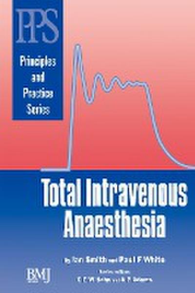 Total Intravenous Anaesthesia