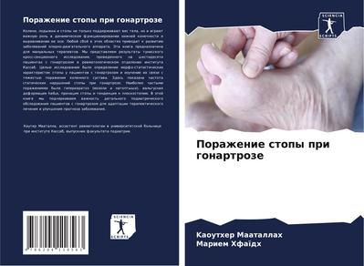 Porazhenie stopy pri gonartroze