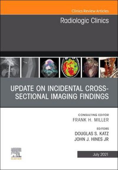 Update on Incidental Cross-Sectional Imaging Findings, an Issue of Radiologic Clinics of North America