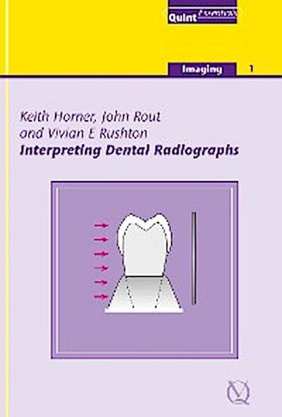 Interpreting Dental Radiographs