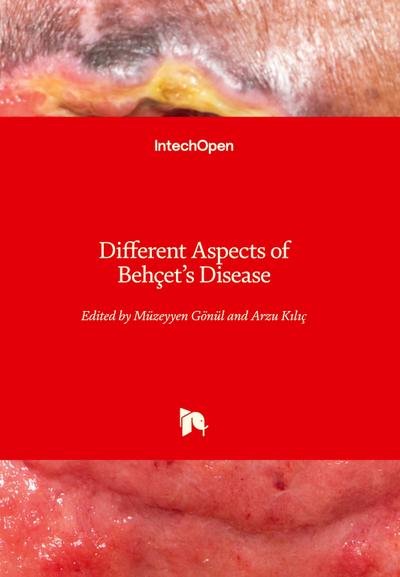 Different Aspects of Behçet’s Disease