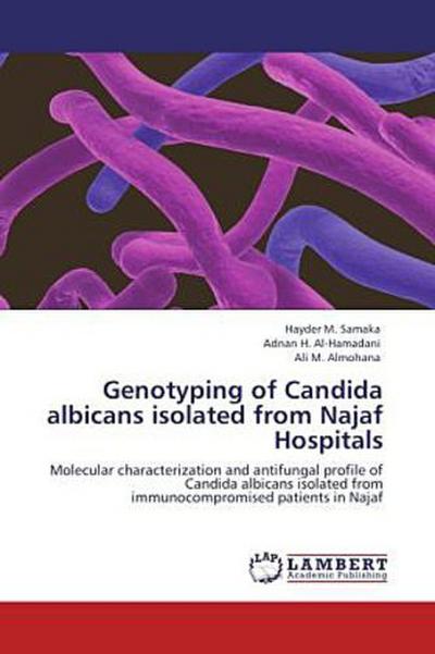 Genotyping of Candida albicans isolated from Najaf Hospitals