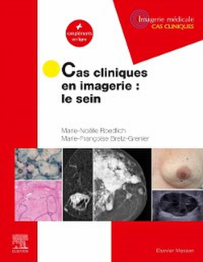 Cas cliniques en imagerie : le sein