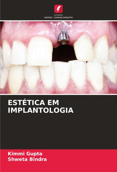 ESTÉTICA EM IMPLANTOLOGIA
