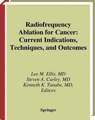 Radiofrequency Ablation for Cancer
