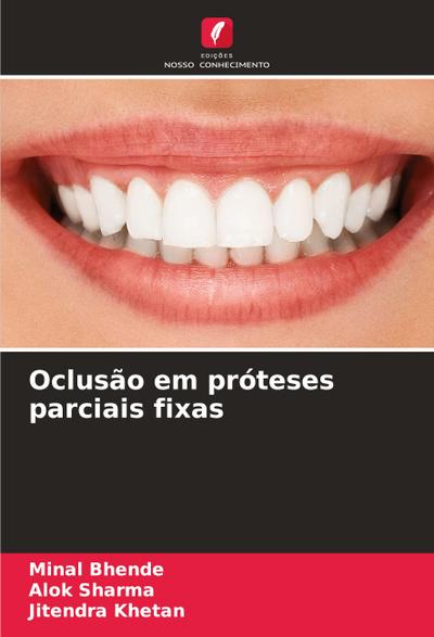 Oclusão em próteses parciais fixas