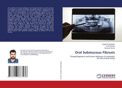 Oral Submucous Fibrosis