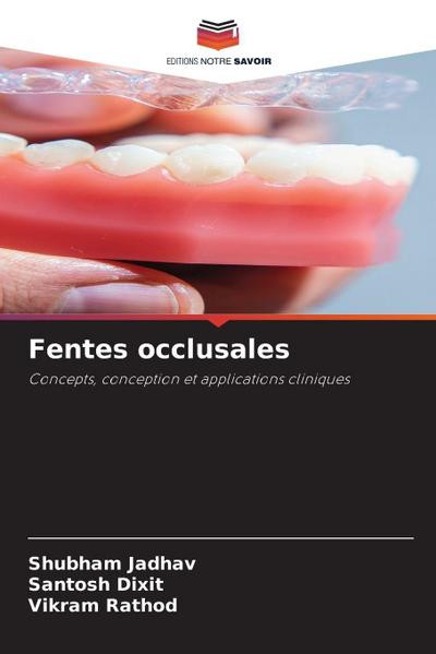 Fentes occlusales