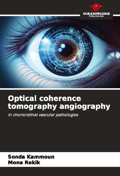 Optical coherence tomography angiography