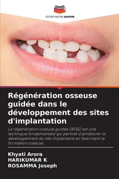 Régénération osseuse guidée dans le développement des sites d’implantation