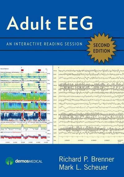 Adult EEG