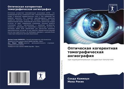 Opticheskaq kogerentnaq tomograficheskaq angiografiq