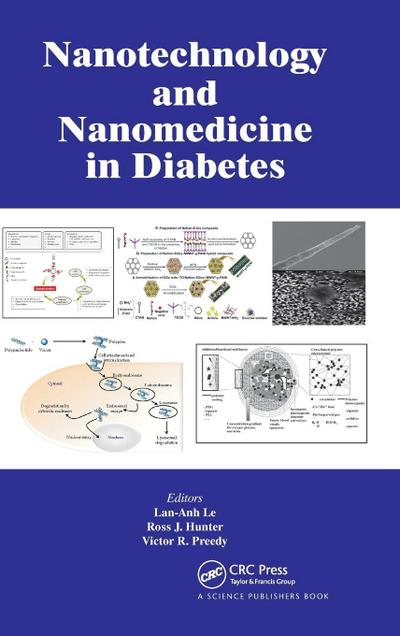 Nanotechnology and Nanomedicine in Diabetes