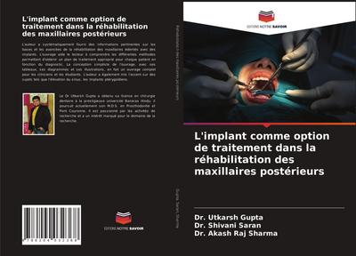 L’implant comme option de traitement dans la réhabilitation des maxillaires postérieurs
