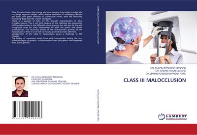CLASS III MALOCCLUSION