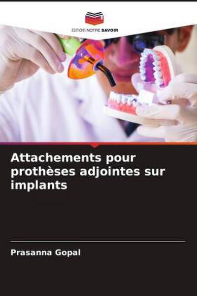 Attachements pour prothèses adjointes sur implants