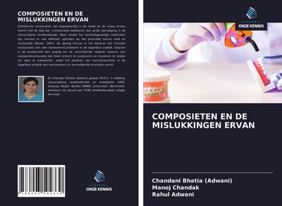 COMPOSIETEN EN DE MISLUKKINGEN ERVAN