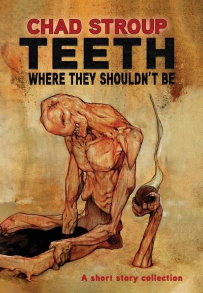 TEETH WHERE THEY SHOULDN’T BE