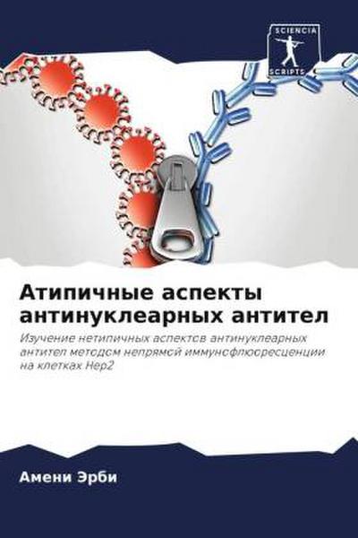 Atipichnye aspekty antinuklearnyh antitel