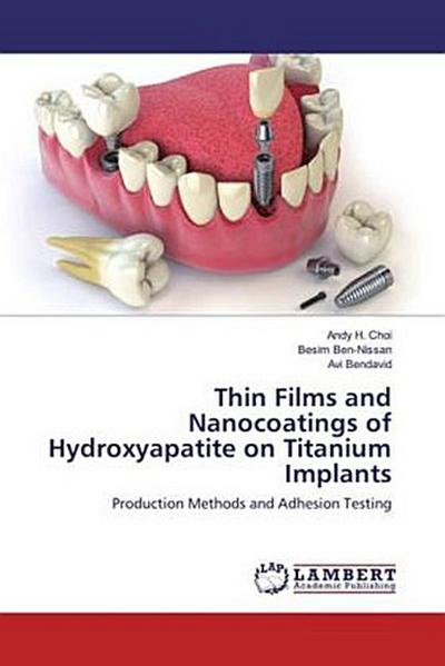 Thin Films and Nanocoatings of Hydroxyapatite on Titanium Implants