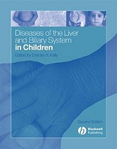 Diseases of the Liver and Biliary System in Children
