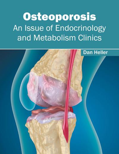 Osteoporosis: An Issue of Endocrinology and Metabolism Clinics