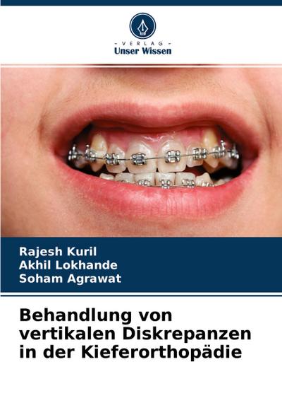 Behandlung von vertikalen Diskrepanzen in der Kieferorthopädie