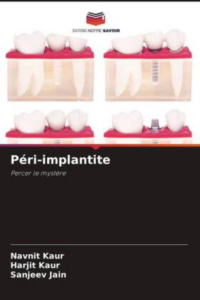 Péri-implantite