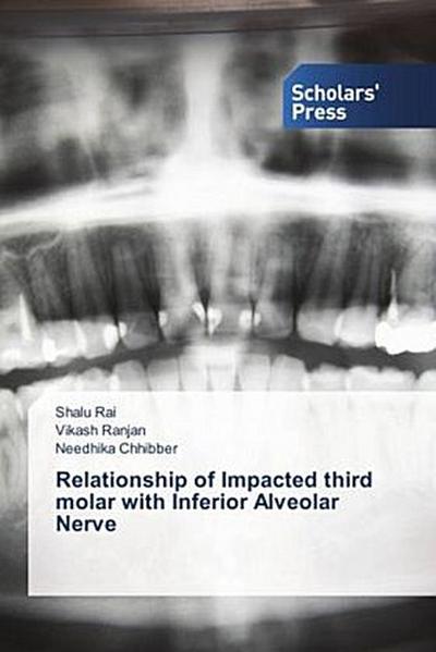 Relationship of Impacted third molar with Inferior Alveolar Nerve