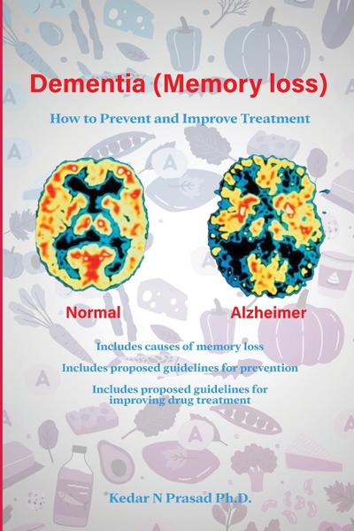 Dementia (Memory Loss)