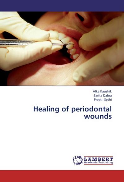 Healing of periodontal wounds