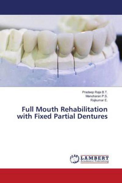 Full Mouth Rehabilitation with Fixed Partial Dentures