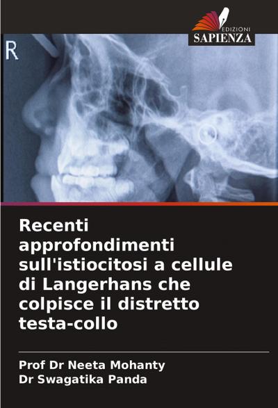 Recenti approfondimenti sull’istiocitosi a cellule di Langerhans che colpisce il distretto testa-collo